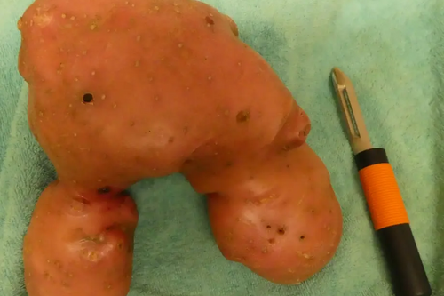 Rudest Potato